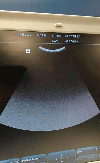 D'occasion ECHOGRAPHE PORTABLE CARDIAQUE MINDRAY M7