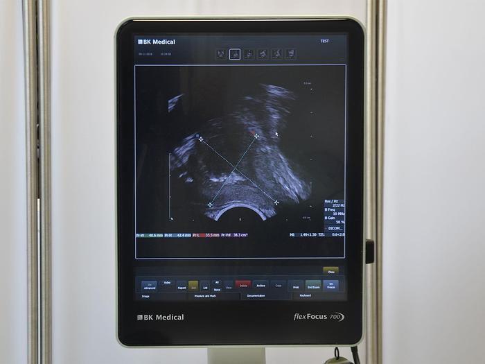 Used ECHOGRAPH BK FOCUS 700 (model 1202)