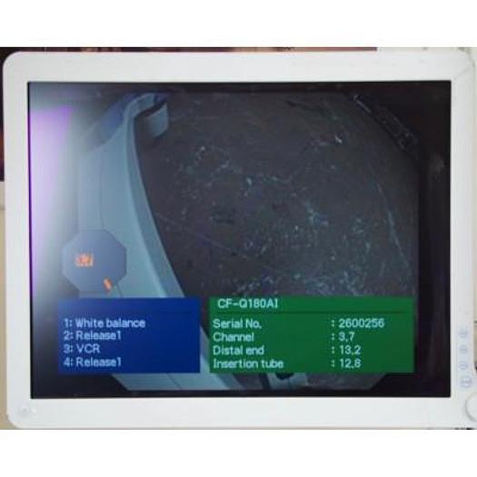 Used OLYMPUS GASTROSCOPY COLUMN WITH FLAT SCREEN 180 SERIES