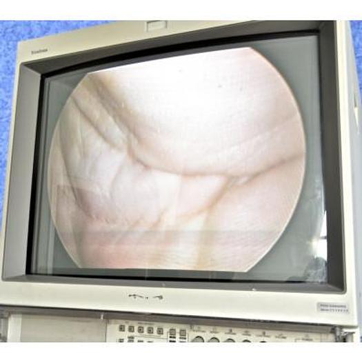 Used OLYMPUS/KEYMED IMAGING TROLLEY TI-1900 WITH SONY TRINITRON MONITOR, DYONICS 300XL XENON LIGHT SOURCE, SMITH AND NEPHEW 350 3-CCD