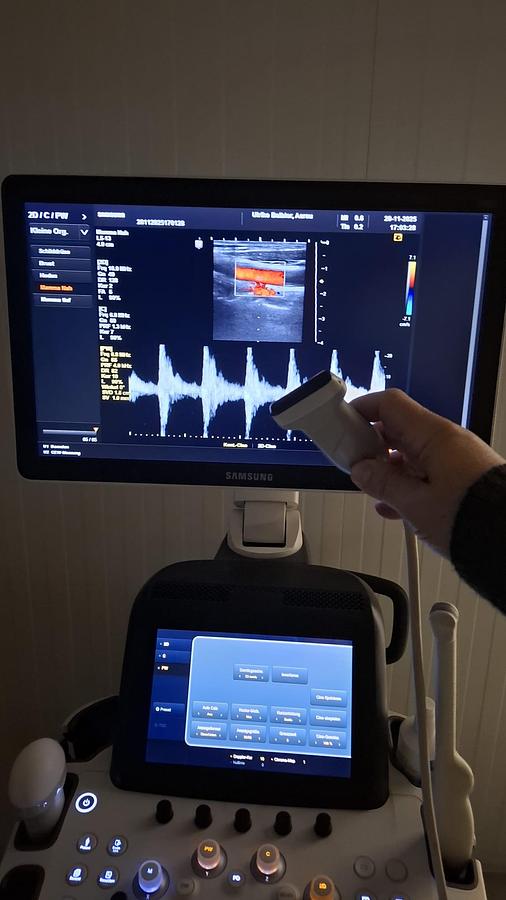 Rénové ECHOGRAPHE GYNECOLOGIQUE SAMSUNG H60