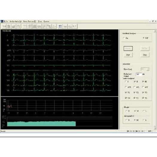 ECG HOLTER