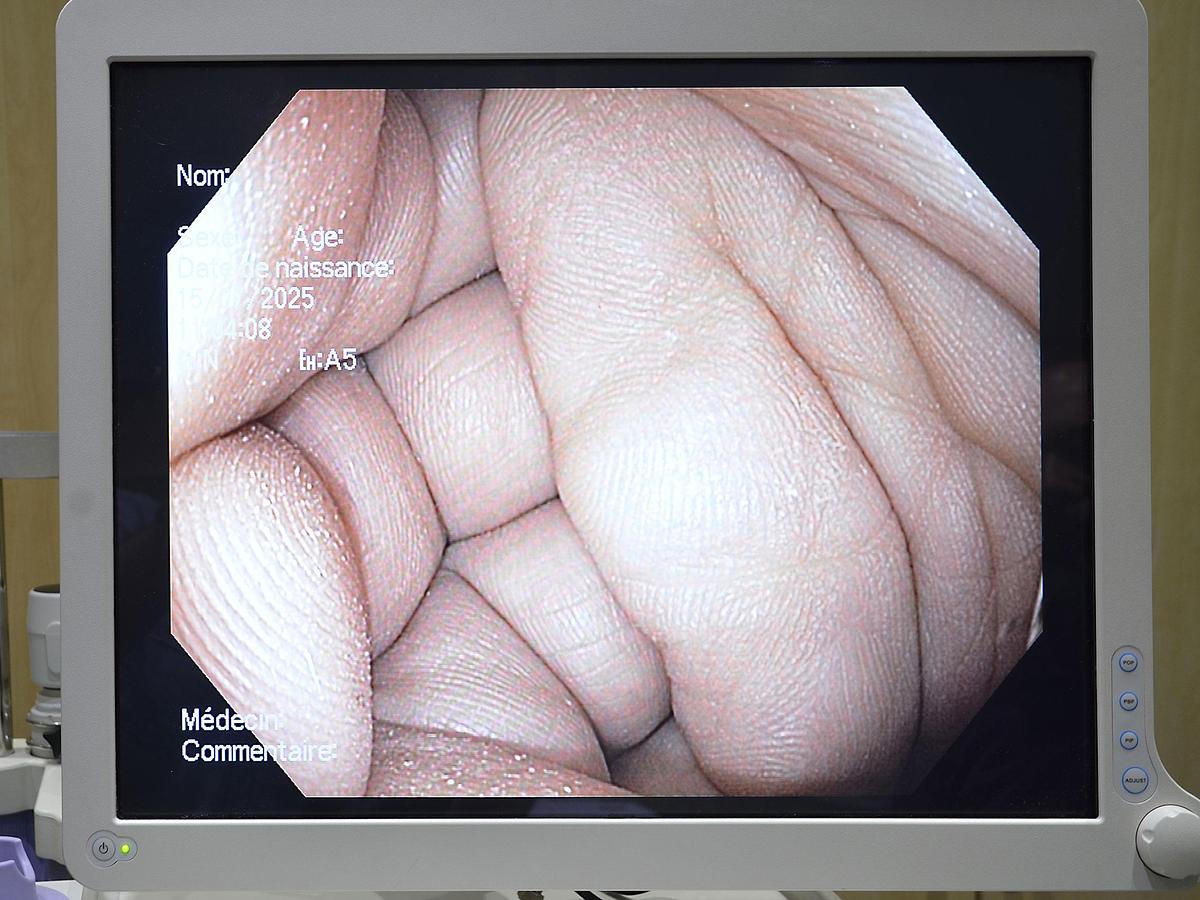 D'occasion OLYMPUS 180 ENDOSCOPY COLUMN