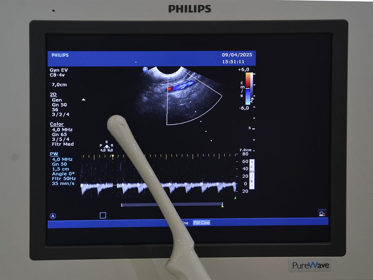 original-d-occasion-echographe-philips-hd-15-2-d-3-d-4-d-gyneco-et-radio.JPG