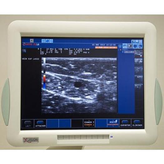 Used MYLAB 40 ESAOTE COLOR DOPPLER ULTRASOUND SCANNER WITH 2 PROBES