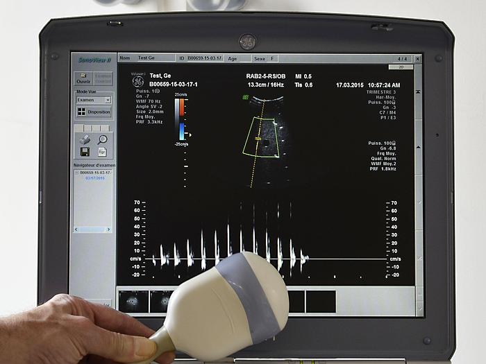 Used GENERAL ELECTRIC VOLUSON-I PORTABLE ULTRASOUND SCANNER ON CART