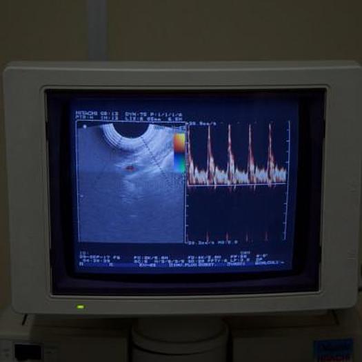 Used HITACHI ODYSSEE DOPPLER ULTRASOUND WITH 2 PROBES