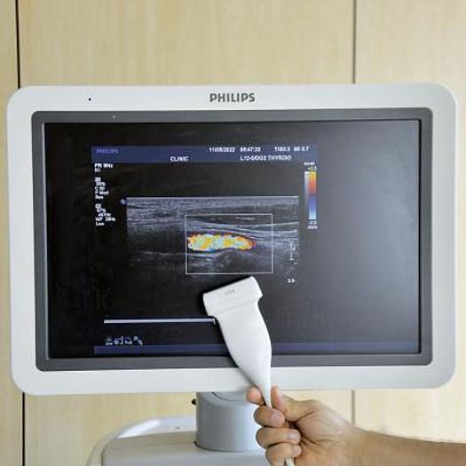 Used PHILIPS IU22 VASCULAR ULTRASOUND SCANNER