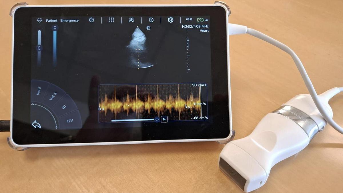 D'occasion ECHOGRAPHE SUPER PORTABLE SONOSCANNER U-LITE PRO AVEC 3 sondes interchangeables : convexe, lineaire, cardiaque