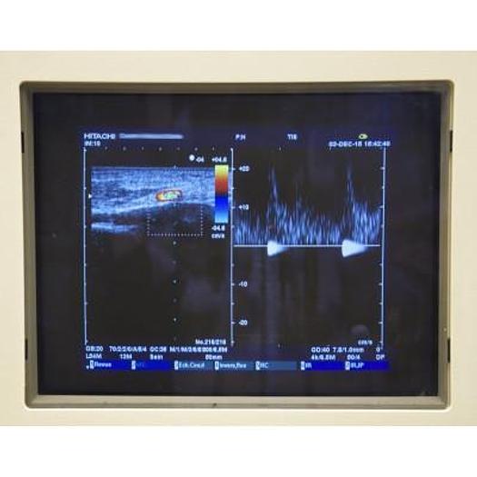 Used HITACHI PLATFORM ELITE DIGITAL COLOR DOPPLER ULTRASOUND WITH 3 PROBES