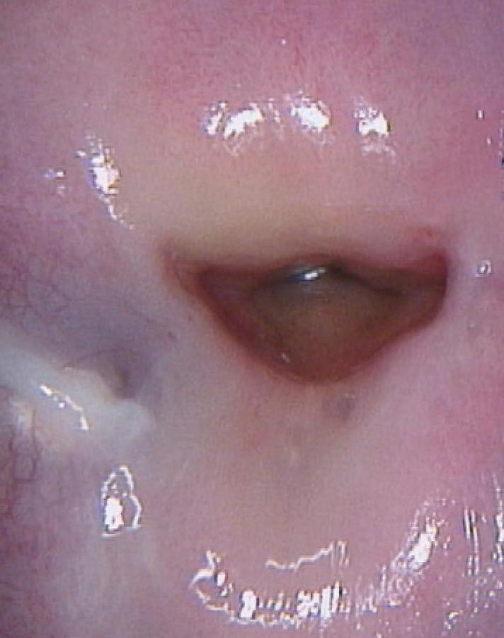 Rénové FAUTEUIL GYNÉCOLOGIQUE SCHMITZ MEDI-MATIC AVEC VIDEO COLPOSCOPE VIDAN INTEGRÉ ET ECRAN