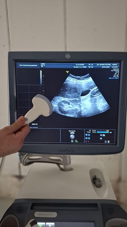 D'occasion ULTRASOUND GENERAL ELECTRIC GE VOLUSON E6