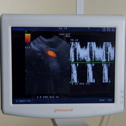 Used ALOKA SSD-3500 PROSOUND ULTRASOUND SCANNER, FLAT SCREEN AND 3 PROBES