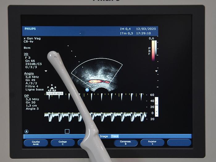 original-d-occasion-echographe-philips-hd-11-xe.JPG