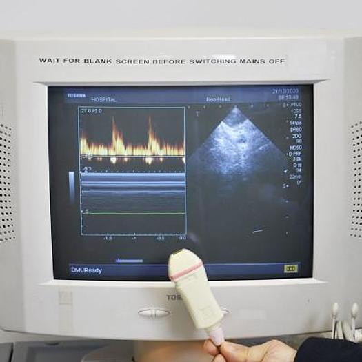 Used TOSHIBA NEMIO 35 ECHOCARDIOGRAPH