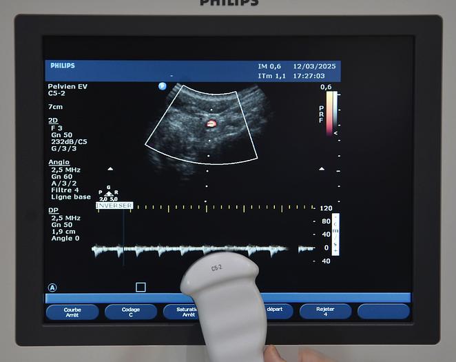 original-d-occasion-echographe-philips-hd-11-xe.JPG
