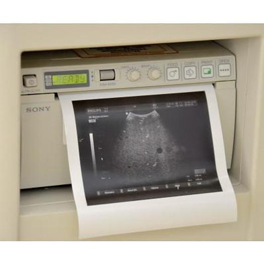 Used PHILIPS HD3 COLOR DOPPLER ULTRASOUND WITH ABDOMINAL PROBE AND ENDOVAGINAL PROBE