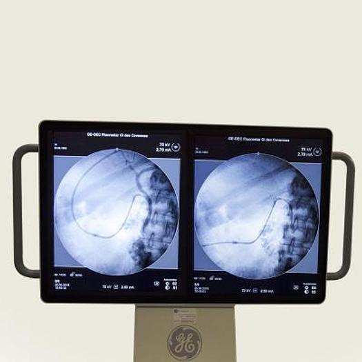 Used BRILLIANCE AMPLIFIER (04/2018) GENERAL ELECTRIC FLUOROSTAR for general and vascular applications