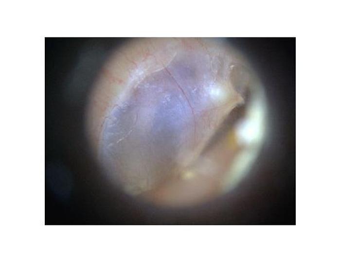 DIGITAL OTOSCOPE VIDEO OTOSCOPE EARSCOPE PRO, DINO-LITE