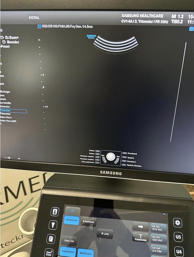 D'occasion ECHOGRAPHE SAMSUNG HS 70