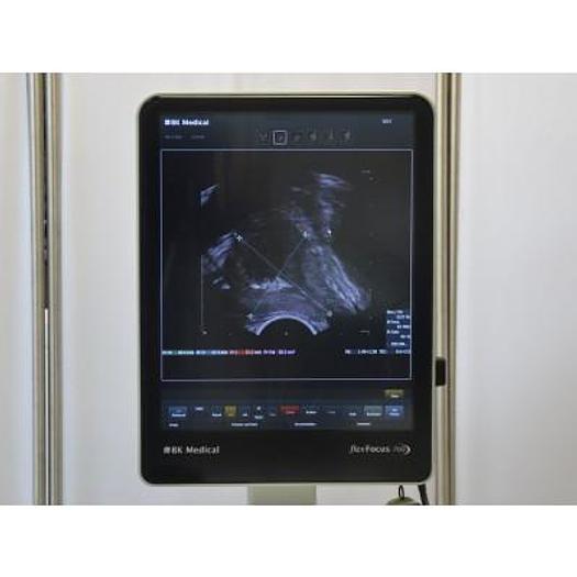 Used ECHOGRAPH BK FOCUS 700 (model 1202)