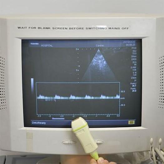 Used TOSHIBA NEMIO 35 ECHOCARDIOGRAPH