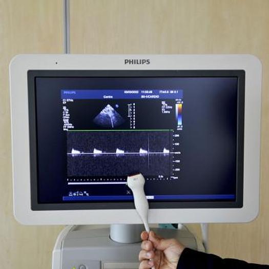 Used PHILIPS IU22 ULTRASOUND SCANNER (RADIO+CARDIO+GYNECO)