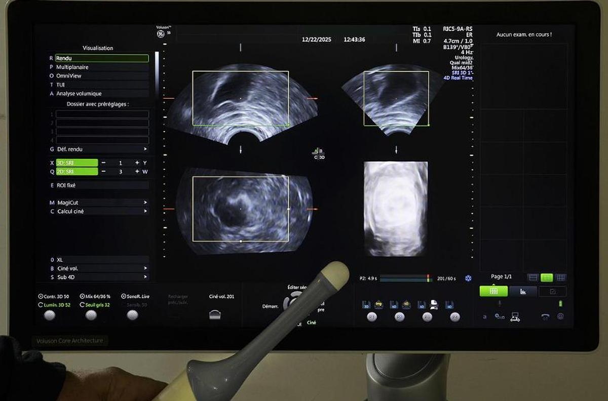 D'occasion GENEAL ELECTRIC VOLUSON S6 ULTRASOUND UNIT