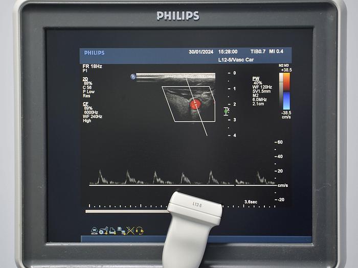 D'occasion ECHOCARDIOGRAPHE PHILIPS IE33 CARDIAQUE