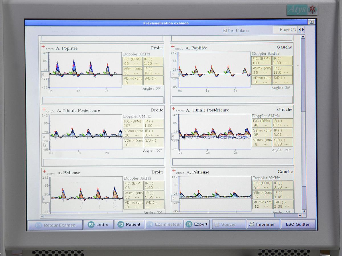 D'occasion ATYS WAKIE TRANSCRANIAL DOPPLER WITH 2 PROBES (X MHZ and Y MHZ)