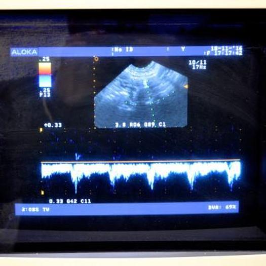 Used ALOKA SSD 4000 COLOR DOPPLER ULTRASOUND SCANNER WITH 2 PROBES