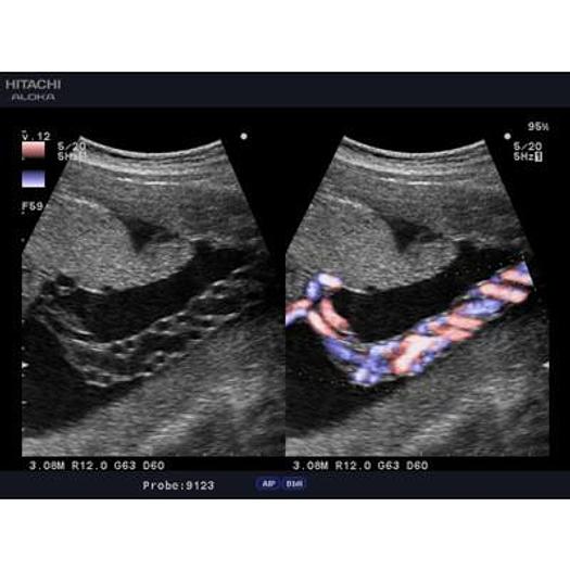 Used ALOKA SSD 4000 COLOR DOPPLER ULTRASOUND SCANNER