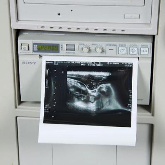Used ULTRASOUND SCANNER TOSHIBA SSA 790A APLIO XG FLAT SCREEN WITH 3 PROBES