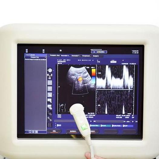 Used HITACHI PLATFORM ELITE DIGITAL COLOR DOPPLER ULTRASOUND WITH 3 PROBES