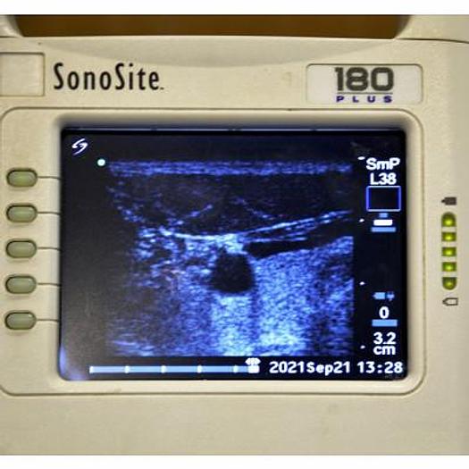 Used SONOSITE 180 PORTABLE ULTRASOUND SCANNER WITH CONVEX ABDOMINAL AND LINEAR SUPERFICIAL PROBES