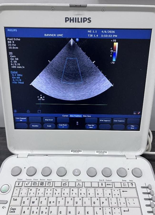 D'occasion CARDIAC-VASCULAR PHILIPS CX 50 PORTABLE ULTRASOUND