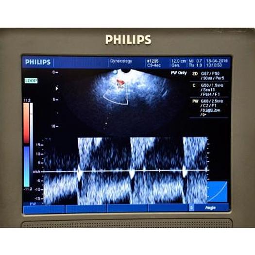 Used PHILIPS HD3 COLOR DOPPLER ULTRASOUND WITH ABDOMINAL PROBE AND ENDOVAGINAL PROBE