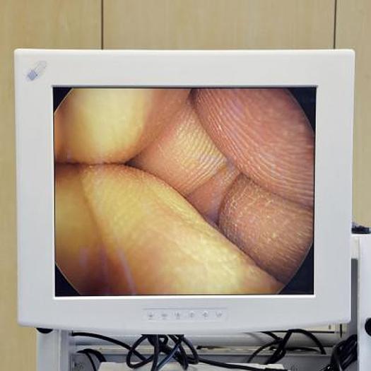 Used KARL STORZ ENDOSCOPY COLUMN WITH MONITOR