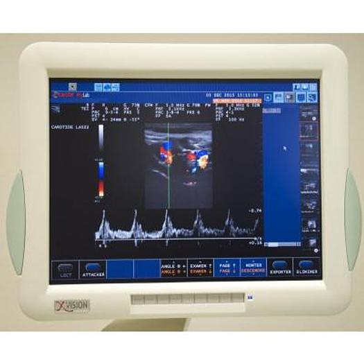 Used MYLAB 40 ESAOTE COLOR DOPPLER ULTRASOUND SCANNER WITH 2 PROBES