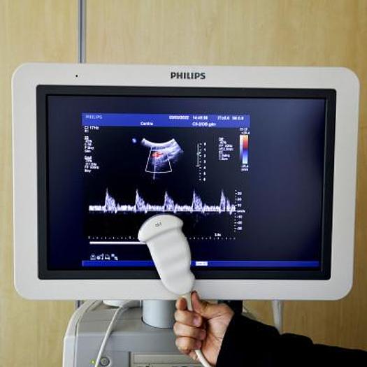 Used PHILIPS IU22 ULTRASOUND SCANNER (RADIO+CARDIO+GYNECO)