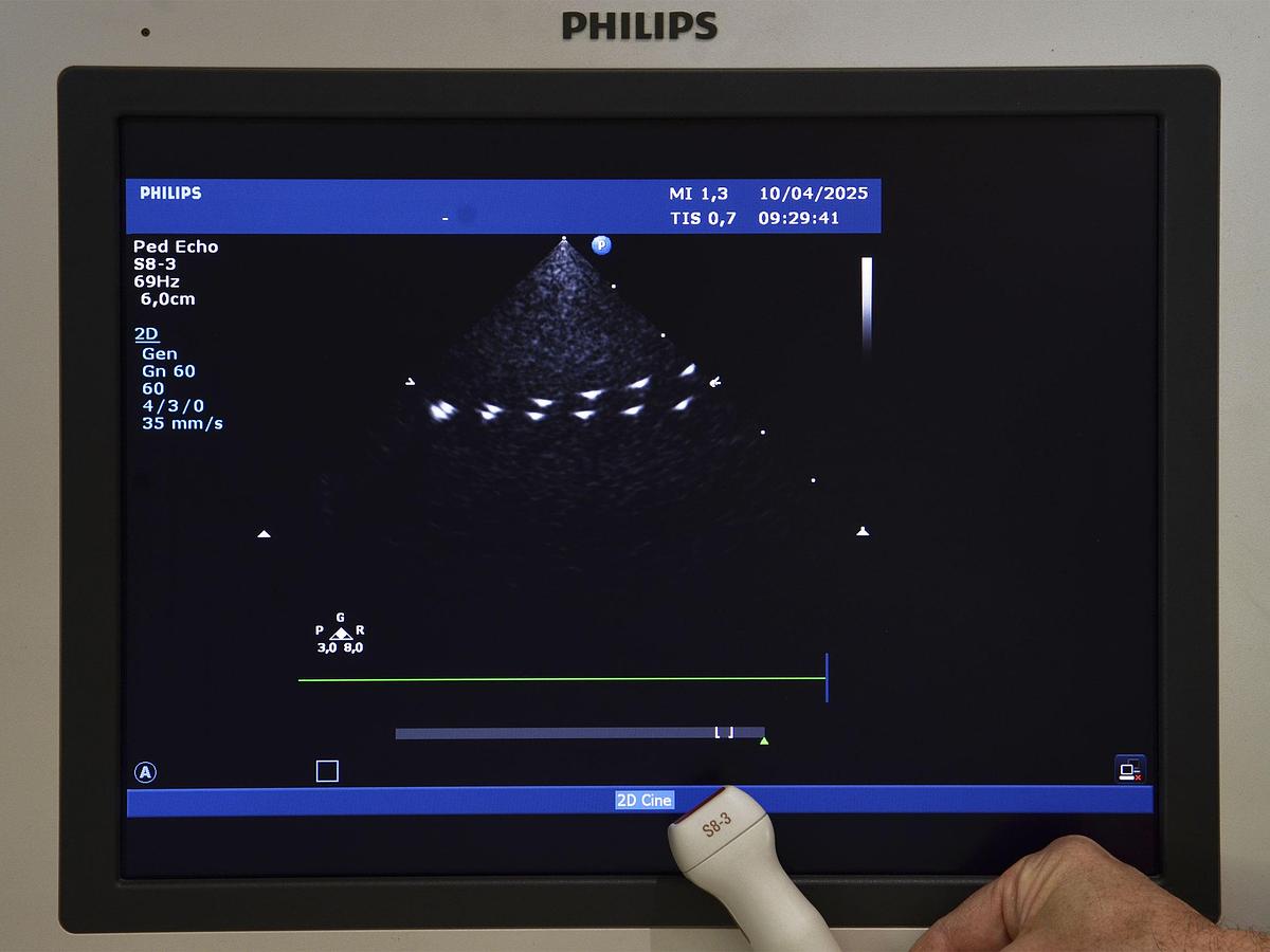 original-d-occasion-echographe-philips-hd-15-2-d-3-d-4-d-gyneco-et-radio.JPG