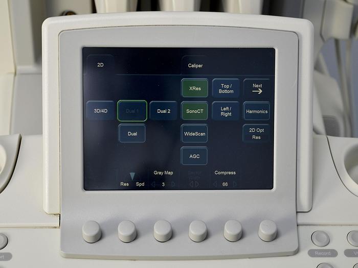 D'occasion ECHOGRAPHE PHILIPS IU22