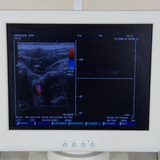 Used HITACHI EUB-5500 COLOR ULTRASOUND SCANNER WITH FLAT SCREEN AND THREE PROBES
