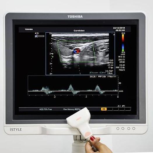 Used TOSHIBA APLIO MX ULTRASOUND SCANNER