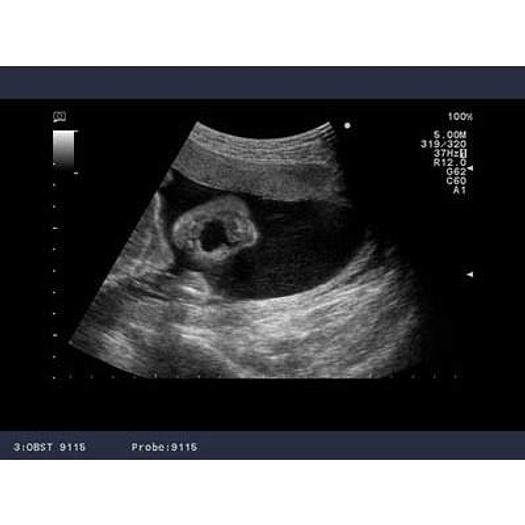 ALOKA ALPHA 10 3D 4D RADIO ULTRASOUND SCANNER