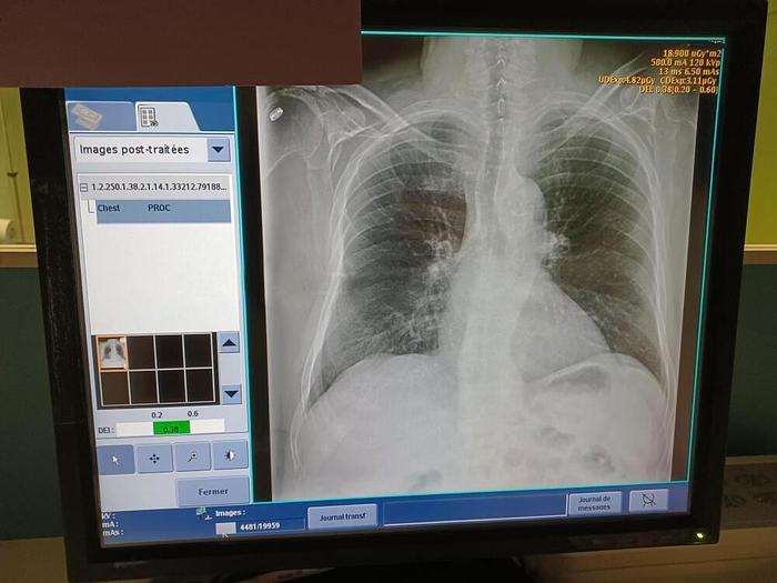 Used RADIO ROOM BONE LUNG GENERAL ELECTRIC DEFINIUM 5000