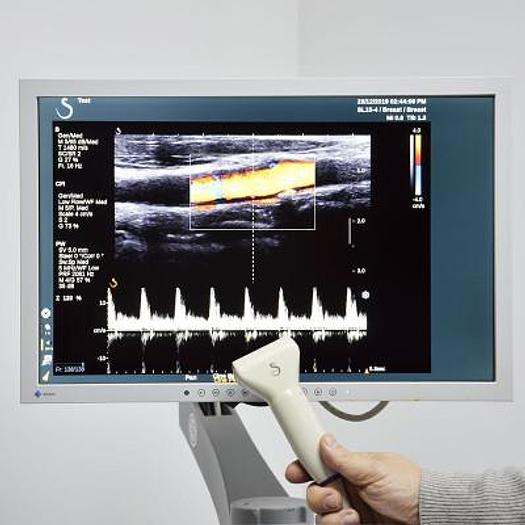 Used IMAGINE AIXPLORER SUPERSONIC ULTRASOUND (MADE IN FRANCE)