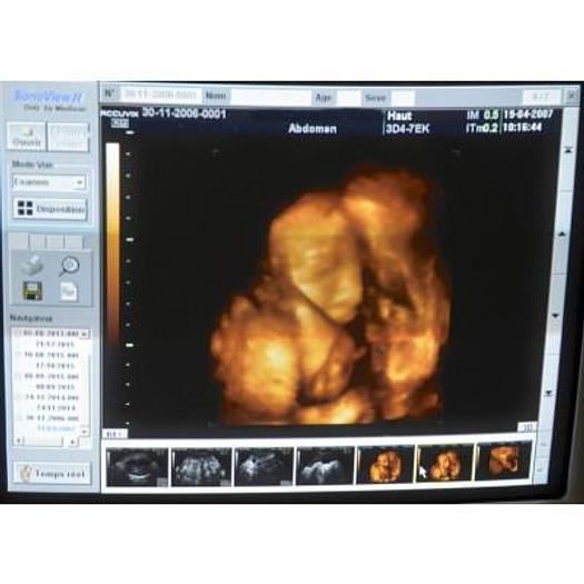 Used ACCUVIX XQ 3D/4D ULTRASOUND SCANNER WITH 4 PROBES