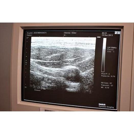 Used DYNAMIC IMAGING DIASUS ULTRASOUND SCANNER WITH 2 PROBES