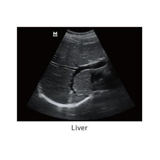 MINDRAY Z5 COLOR DOPPLER SYSTEM